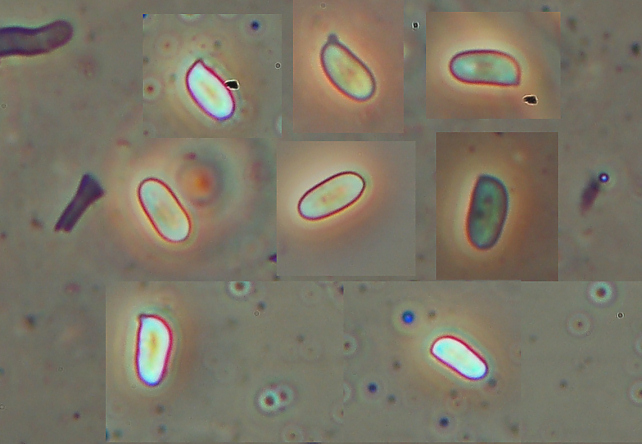 Fotoreportage di uno Stereum (credo!) (Stereum gausapatum)